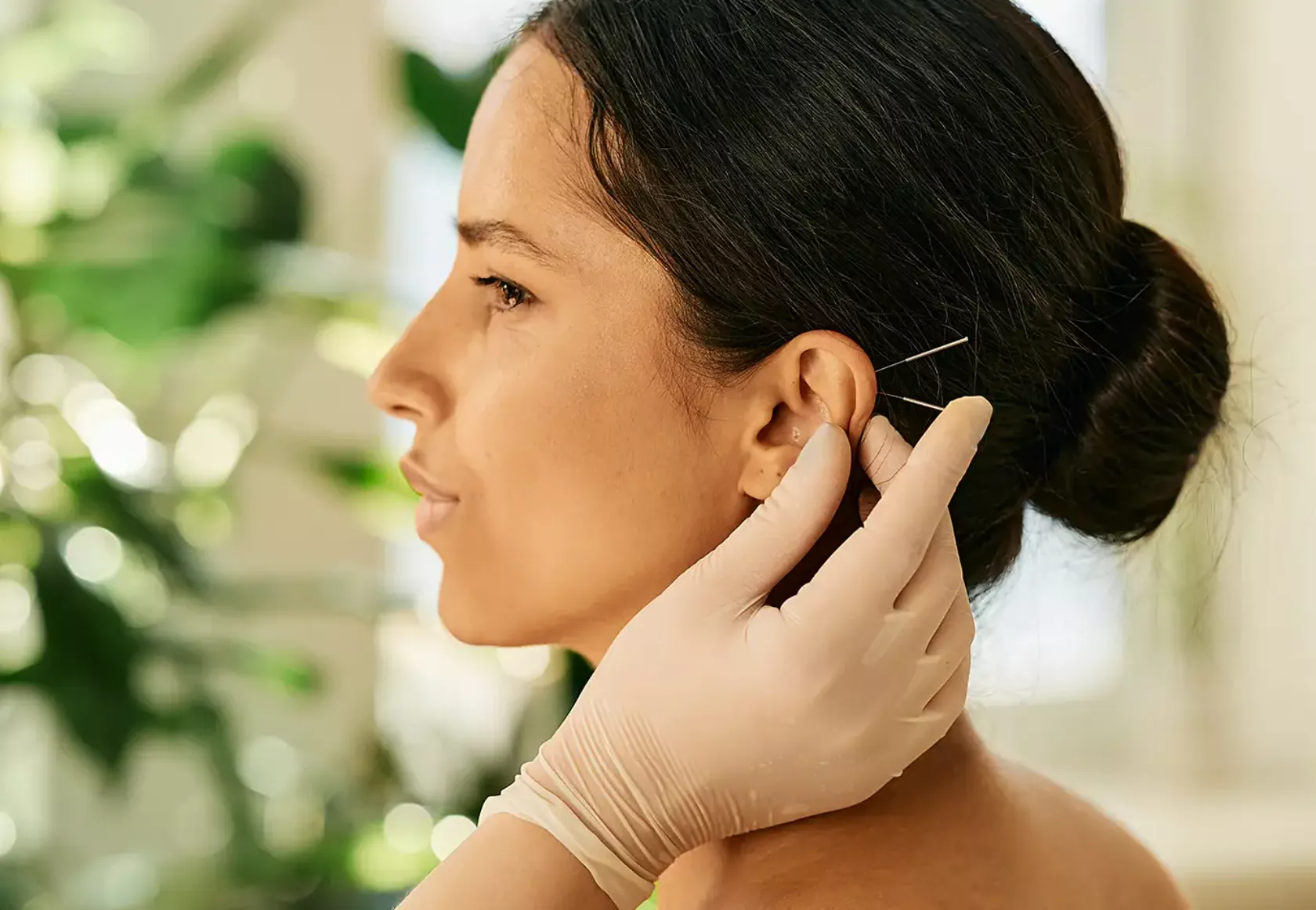 Das Ohr einer Frau wird mit Akupunktur und Akkupressur behandelt.
