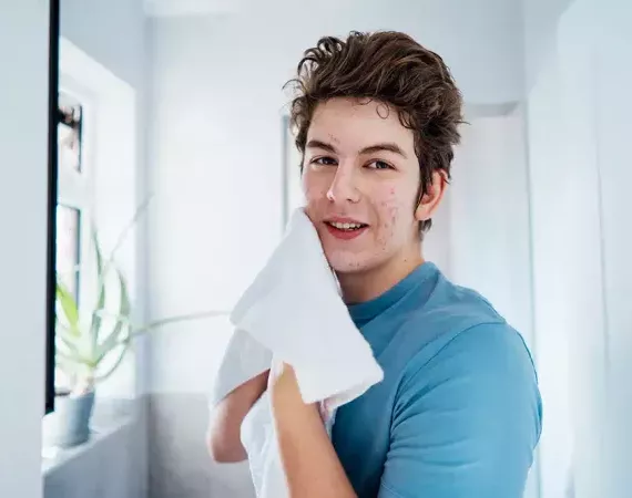 Junger Mann mit Akne im Gesicht trocknet sich nach der Reinigung das Gesicht mit einem Handtuch und blickt in die Kamera..